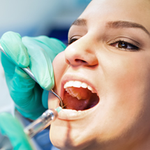 Estética dental en Cerdanyola